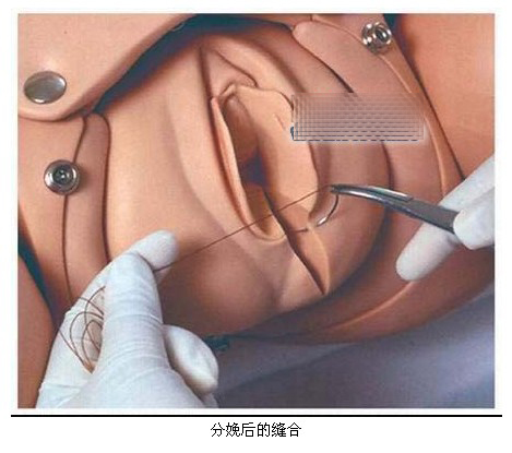 ��������ҽʦΪ����ʾģ�ͷ�����̣�ͼ��